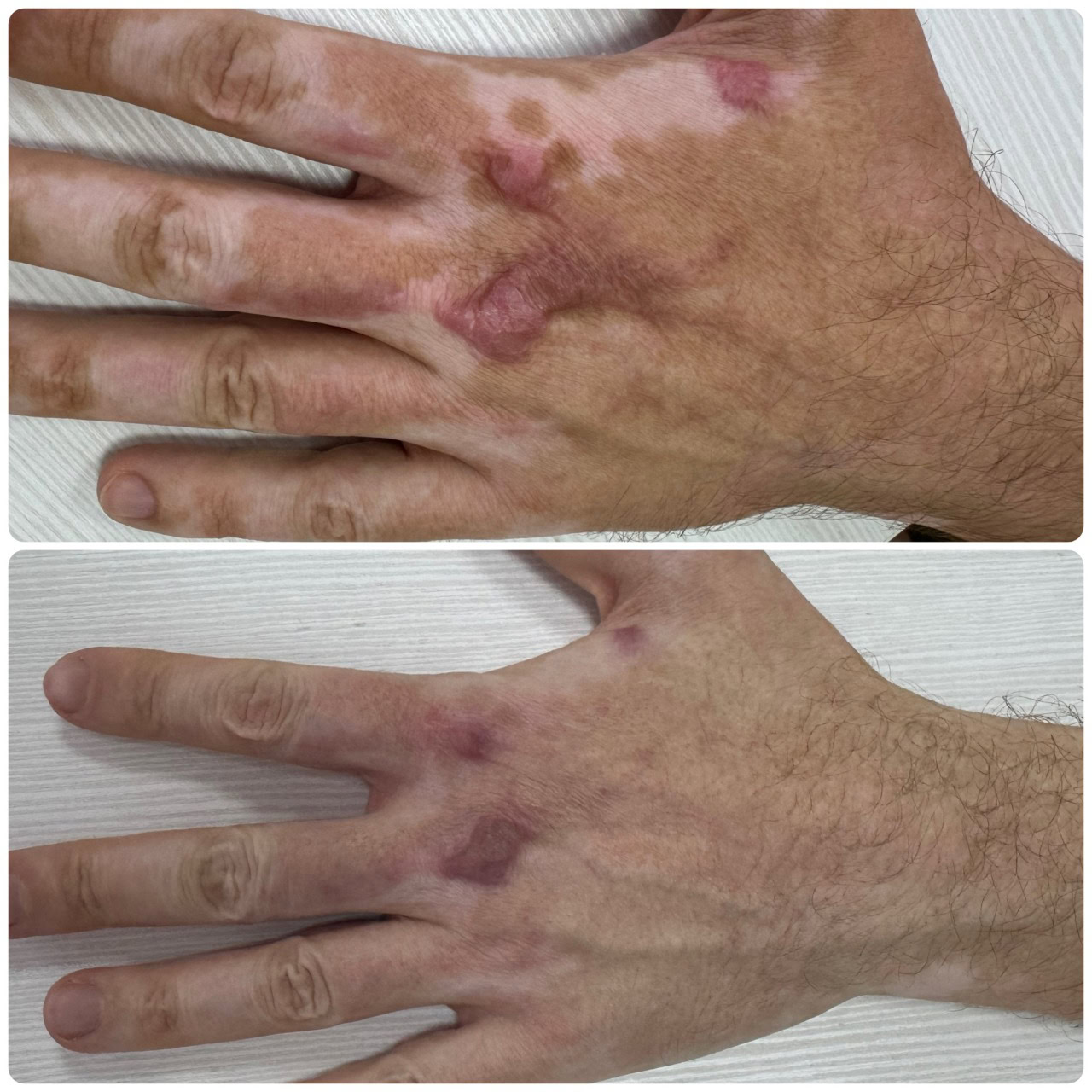 У Дніпрі захисники можуть скористатися програмою лікування опіків і рубців